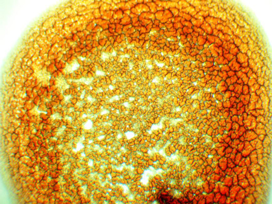 HLB-Test Blut-Bild